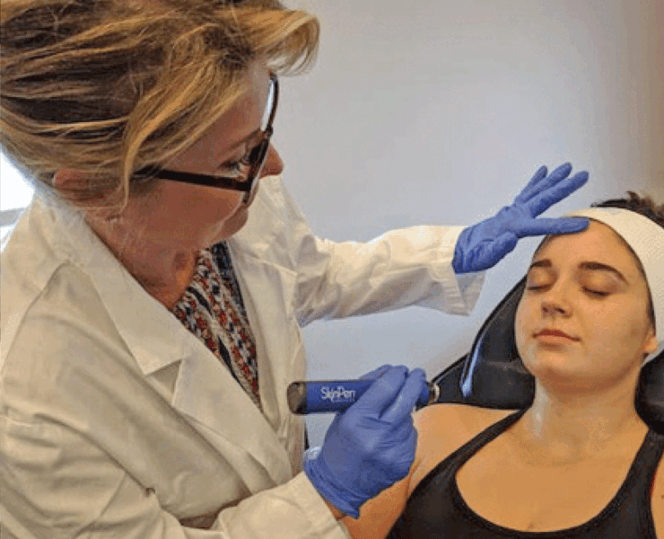 eanne Poss (owner) administering the Skin Pen procedure. Photo courtesy of VA Regenerative Medicine and Spa.